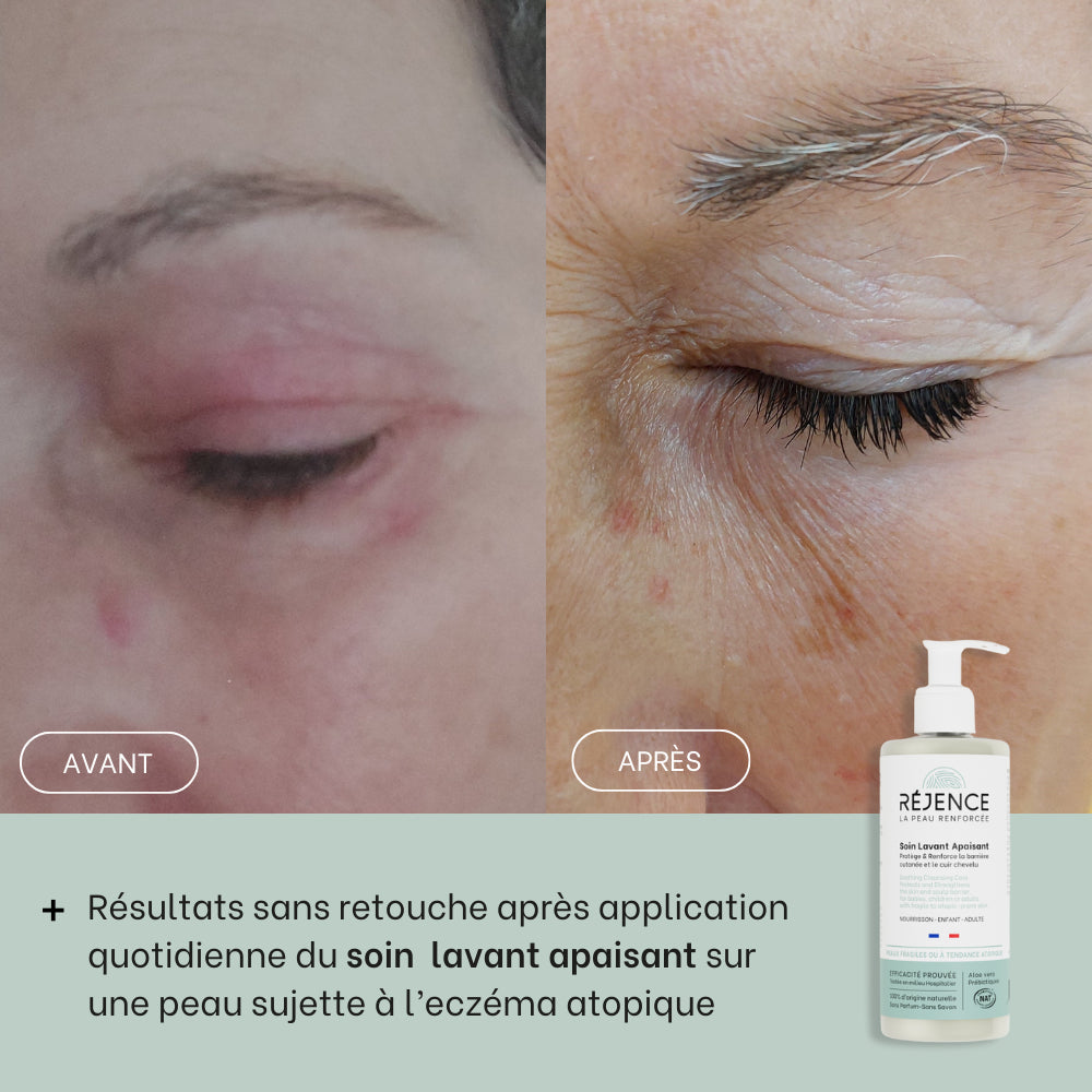 SOIN LAVANT APAISANT PEAU ATOPIQUE SANS CORTISONE - Renaissance Beauté Officiel